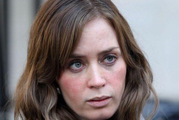 Emily Blunt - rozacea