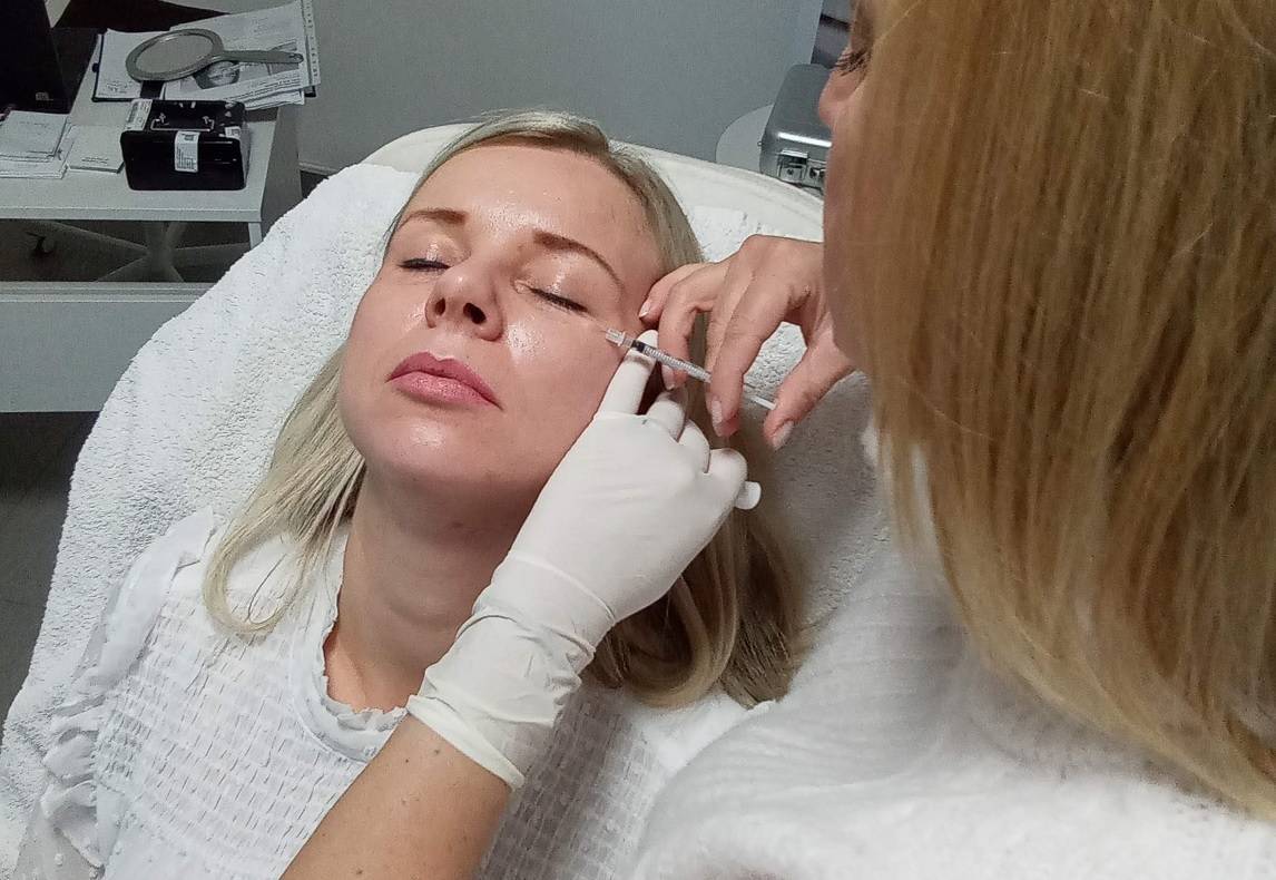 botox zakrok ukazka