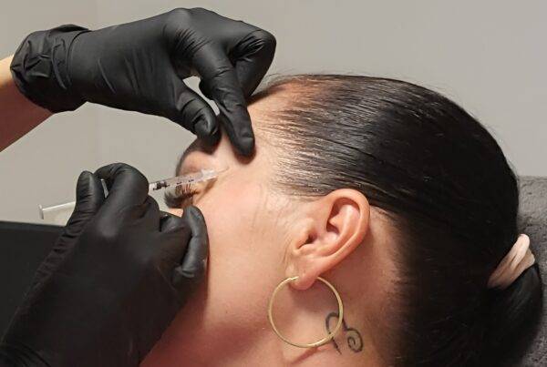 Botox aplikacia ihlou